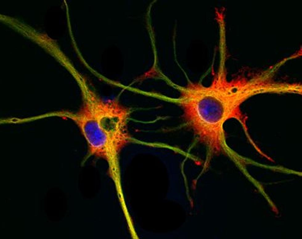 Stem Cells - a Divided Future - Rob Nunan